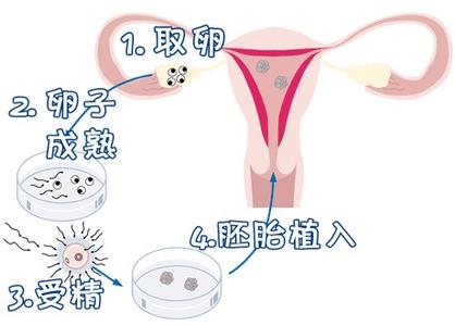 供卵供精公司